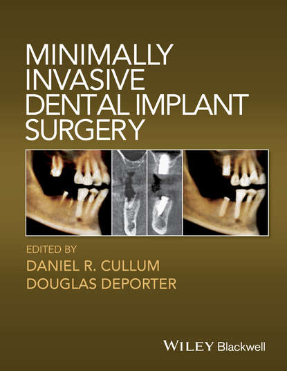 Скачать книгу Minimally Invasive Dental Implant Surgery