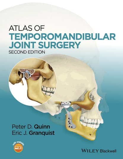 Скачать книгу Atlas of Temporomandibular Joint Surgery