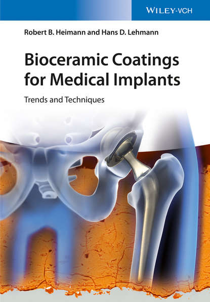 Скачать книгу Bioceramic Coatings for Medical Implants. Trends and Techniques