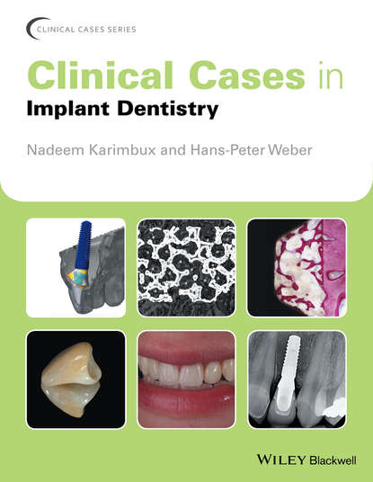 Скачать книгу Clinical Cases in Implant Dentistry
