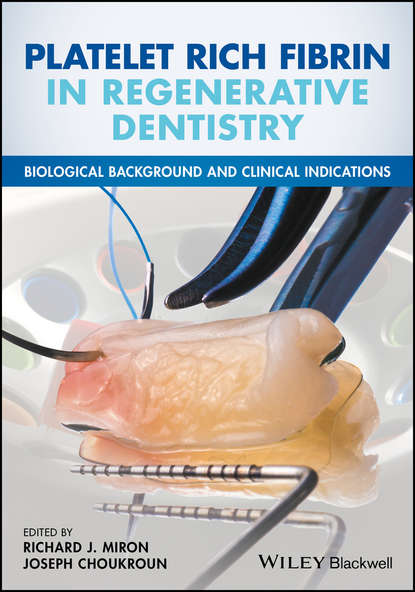 Скачать книгу Platelet Rich Fibrin in Regenerative Dentistry. Biological Background and Clinical Indications