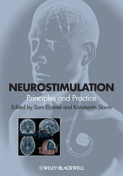 Скачать книгу Neurostimulation. Principles and Practice