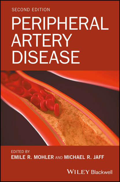 Скачать книгу Peripheral Artery Disease