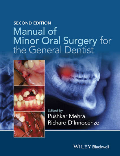 Скачать книгу Manual of Minor Oral Surgery for the General Dentist