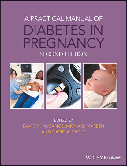 Скачать книгу A Practical Manual of Diabetes in Pregnancy