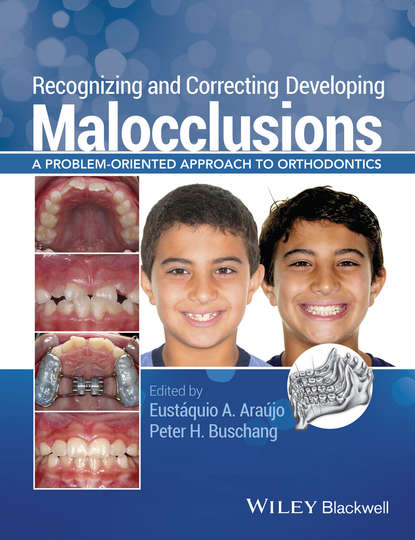 Скачать книгу Recognizing and Correcting Developing Malocclusions. A Problem-Oriented Approach to Orthodontics