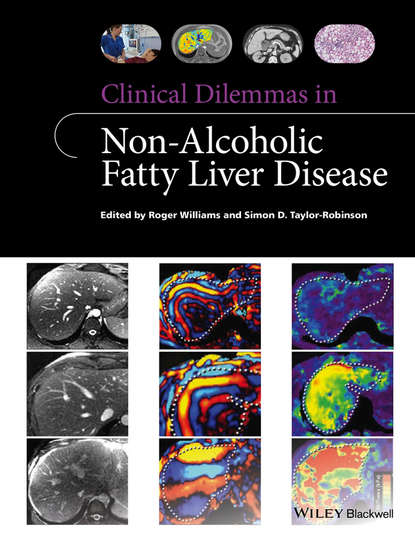 Скачать книгу Clinical Dilemmas in Non-Alcoholic Fatty Liver Disease