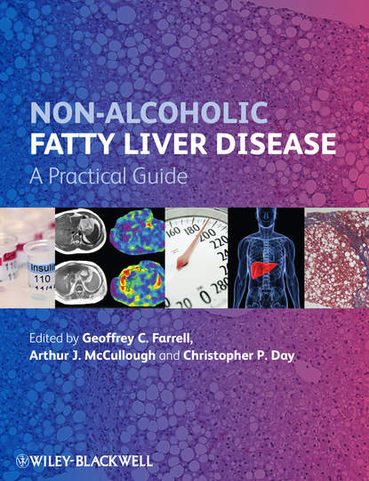 Скачать книгу Non-Alcoholic Fatty Liver Disease. A Practical Guide