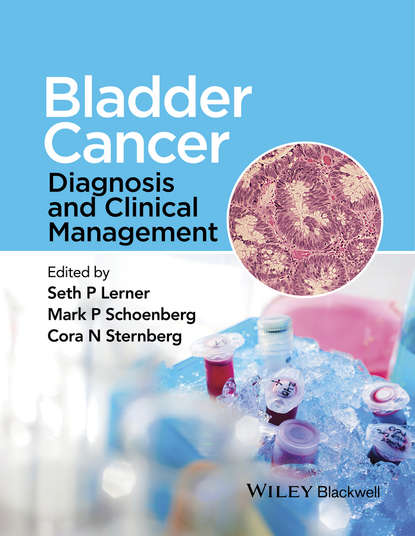 Скачать книгу Bladder Cancer. Diagnosis and Clinical Management