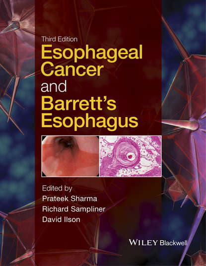 Скачать книгу Esophageal Cancer and Barrett's Esophagus