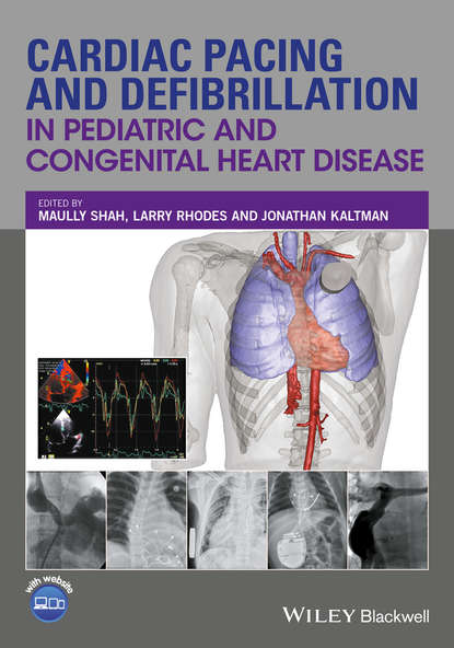 Скачать книгу Cardiac Pacing and Defibrillation in Pediatric and Congenital Heart Disease
