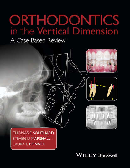 Скачать книгу Orthodontics in the Vertical Dimension. A Case-Based Review