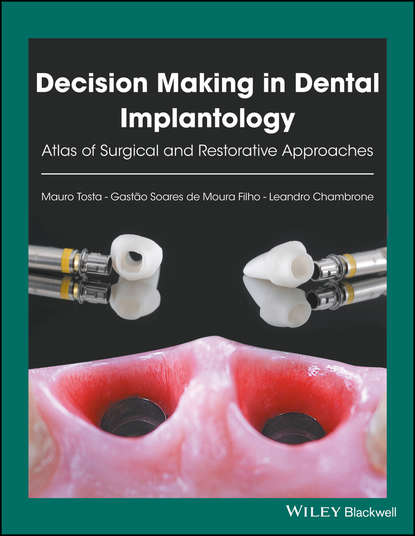 Скачать книгу Decision Making in Dental Implantology. Atlas of Surgical and Restorative Approaches