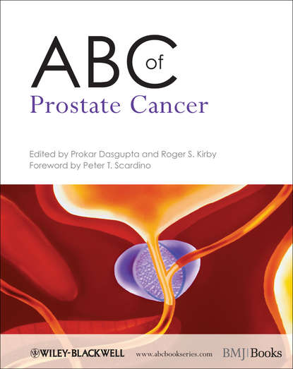 Скачать книгу ABC of Prostate Cancer
