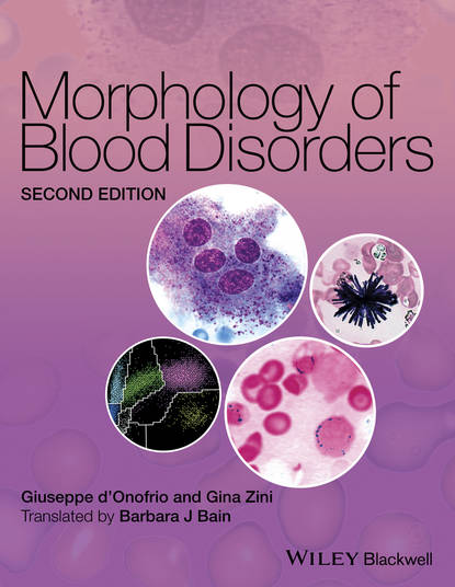 Скачать книгу Morphology of Blood Disorders