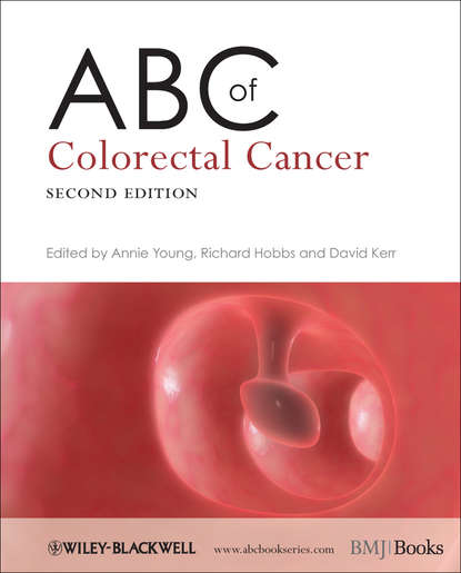 Скачать книгу ABC of Colorectal Cancer