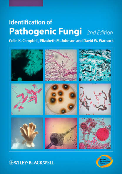 Скачать книгу Identification of Pathogenic Fungi