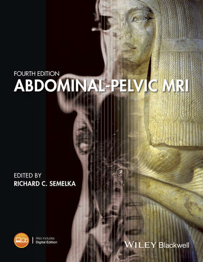 Скачать книгу Abdominal-Pelvic MRI