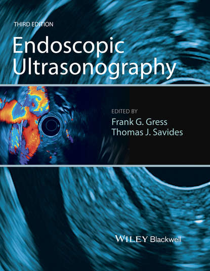 Скачать книгу Endoscopic Ultrasonography