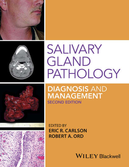 Скачать книгу Salivary Gland Pathology. Diagnosis and Management