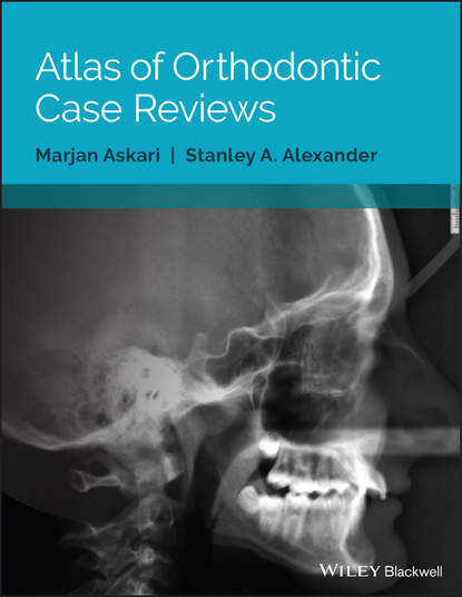 Скачать книгу Atlas of Orthodontic Case Reviews