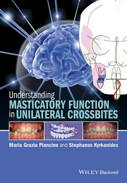 Скачать книгу Understanding Masticatory Function in Unilateral Crossbites