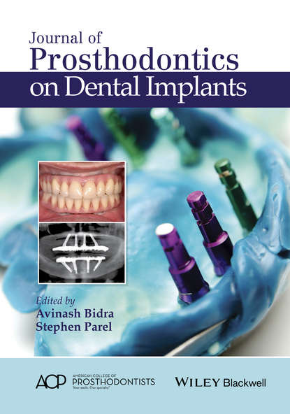 Скачать книгу Journal of Prosthodontics on Dental Implants