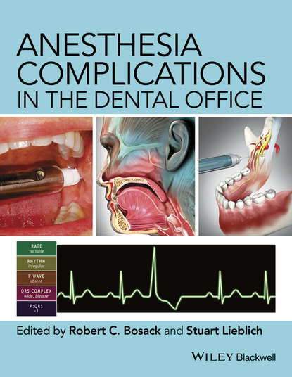 Скачать книгу Anesthesia Complications in the Dental Office