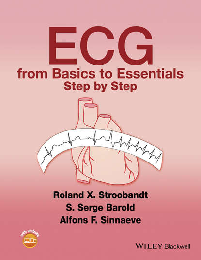 Скачать книгу ECG from Basics to Essentials. Step by Step