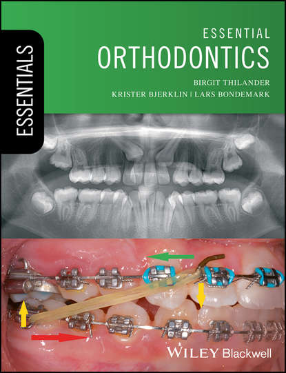 Скачать книгу Essential Orthodontics