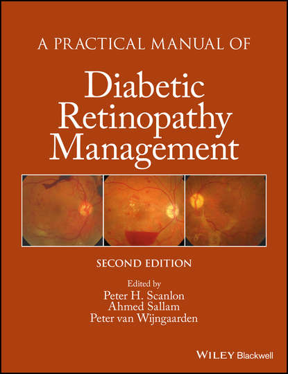 Скачать книгу A Practical Manual of Diabetic Retinopathy Management
