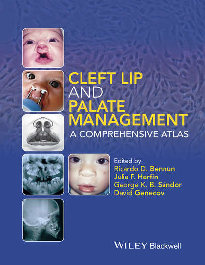 Скачать книгу Cleft Lip and Palate Management. A Comprehensive Atlas