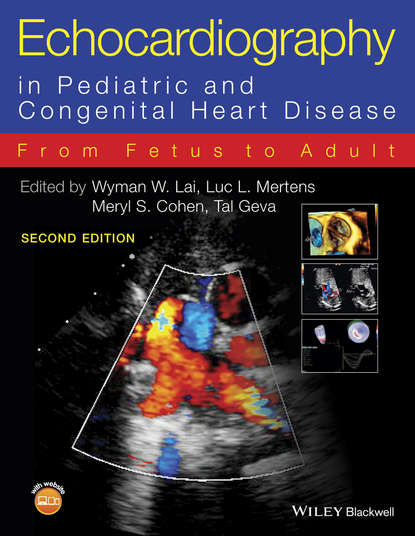 Скачать книгу Echocardiography in Pediatric and Congenital Heart Disease. From Fetus to Adult