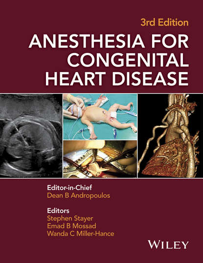 Скачать книгу Anesthesia for Congenital Heart Disease