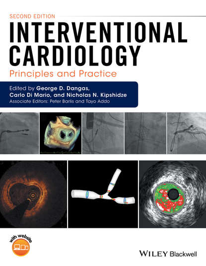 Скачать книгу Interventional Cardiology. Principles and Practice