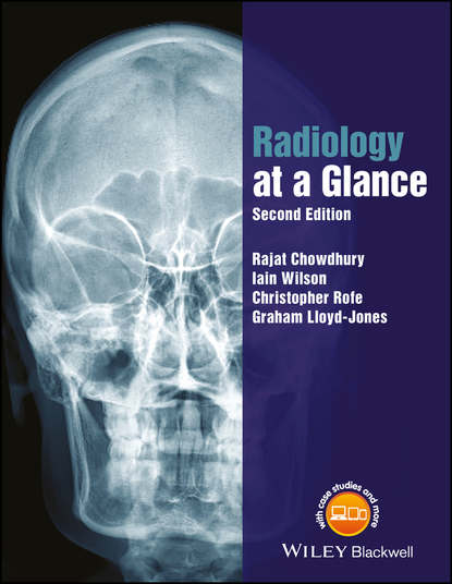 Скачать книгу Radiology at a Glance