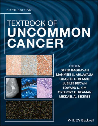 Скачать книгу Textbook of Uncommon Cancer