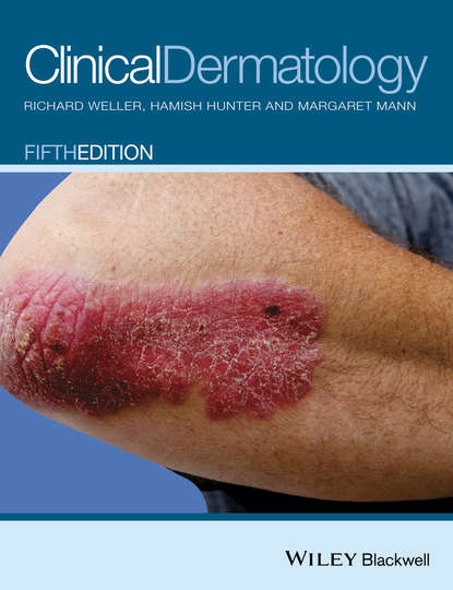 Скачать книгу Clinical Dermatology