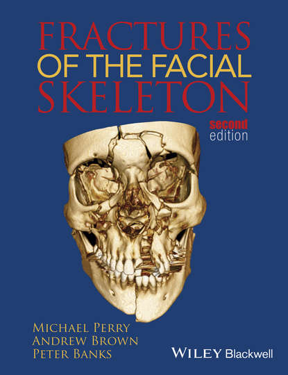 Скачать книгу Fractures of the Facial Skeleton