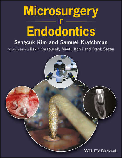 Скачать книгу Microsurgery in Endodontics