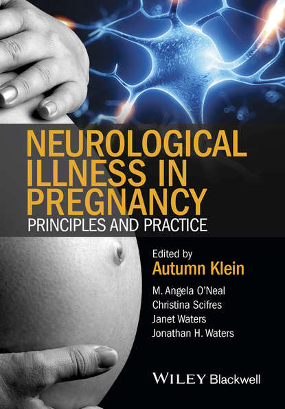 Скачать книгу Neurological Illness in Pregnancy. Principles and Practice