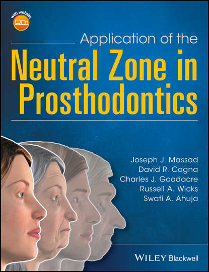 Скачать книгу Application of the Neutral Zone in Prosthodontics