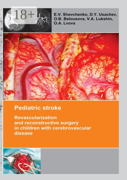 Скачать книгу Pediatric stroke. Revascularization and reconstructive surgery in children with cerebrovascular disease