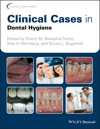 Скачать книгу Clinical Cases in Dental Hygiene