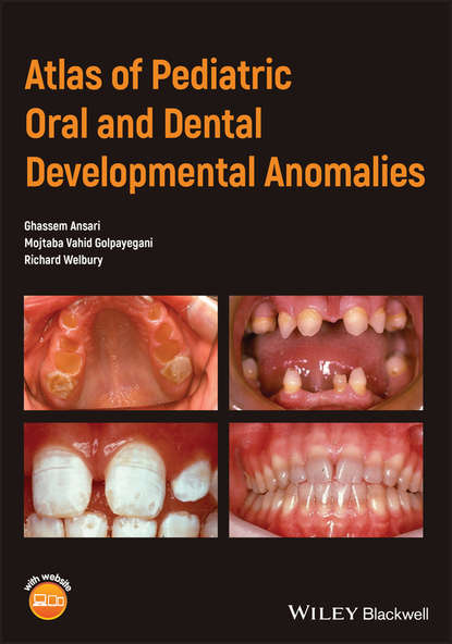 Скачать книгу Atlas of Pediatric Oral and Dental Developmental Anomalies