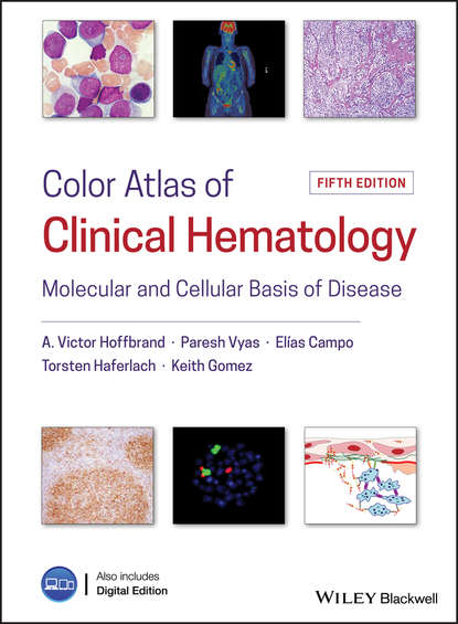 Скачать книгу Color Atlas of Clinical Hematology. Molecular and Cellular Basis of Disease