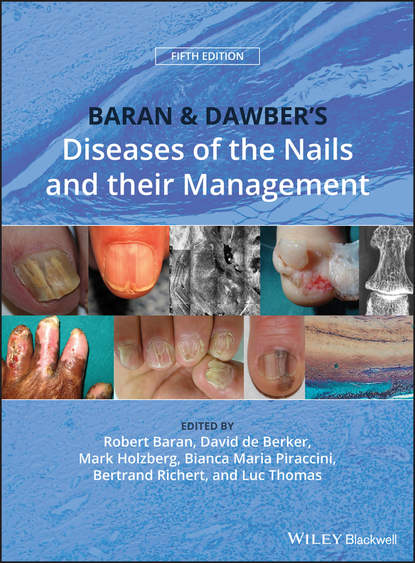 Скачать книгу Baran and Dawber's Diseases of the Nails and their Management