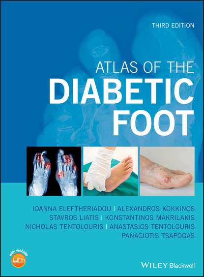 Скачать книгу Atlas of the Diabetic Foot