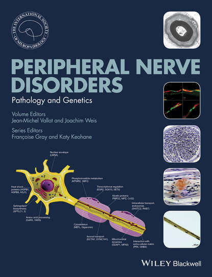 Скачать книгу Peripheral Nerve Disorders