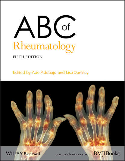Скачать книгу ABC of Rheumatology